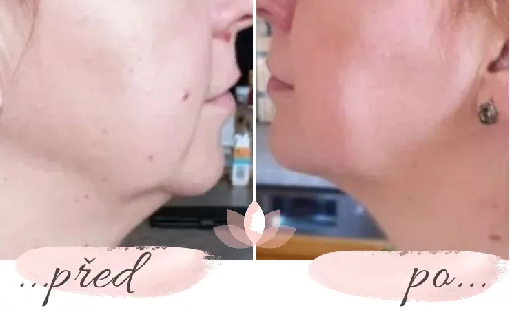 Přehrávání online kurzu obličejové jógy na různých zařízeních